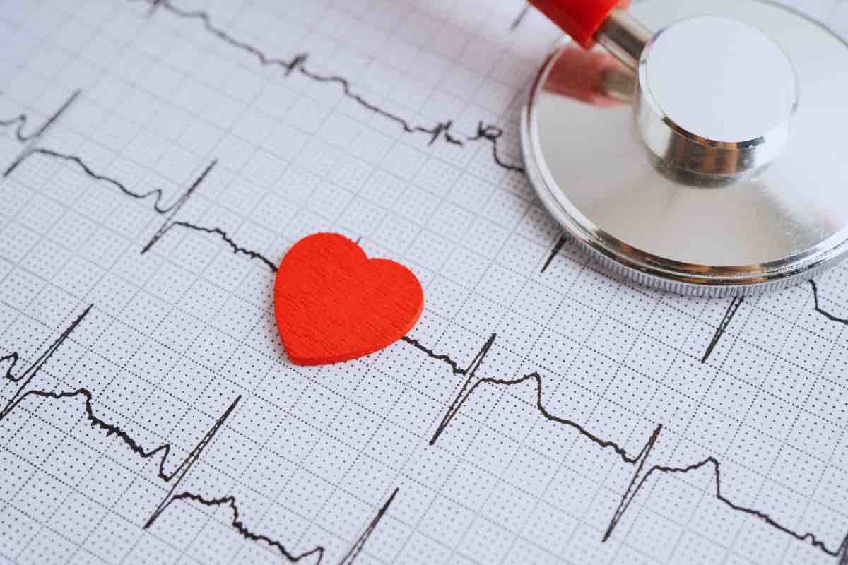 ECG